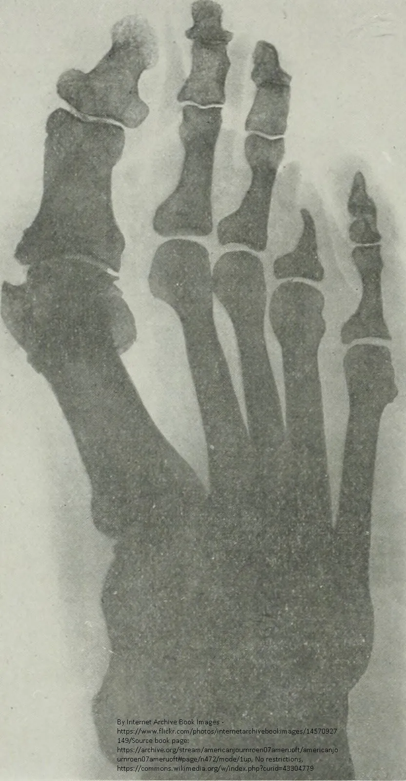 Self-paced Online Home Study 12 CE Foot Reflexology Basics with Advanced Medical Foot Massage